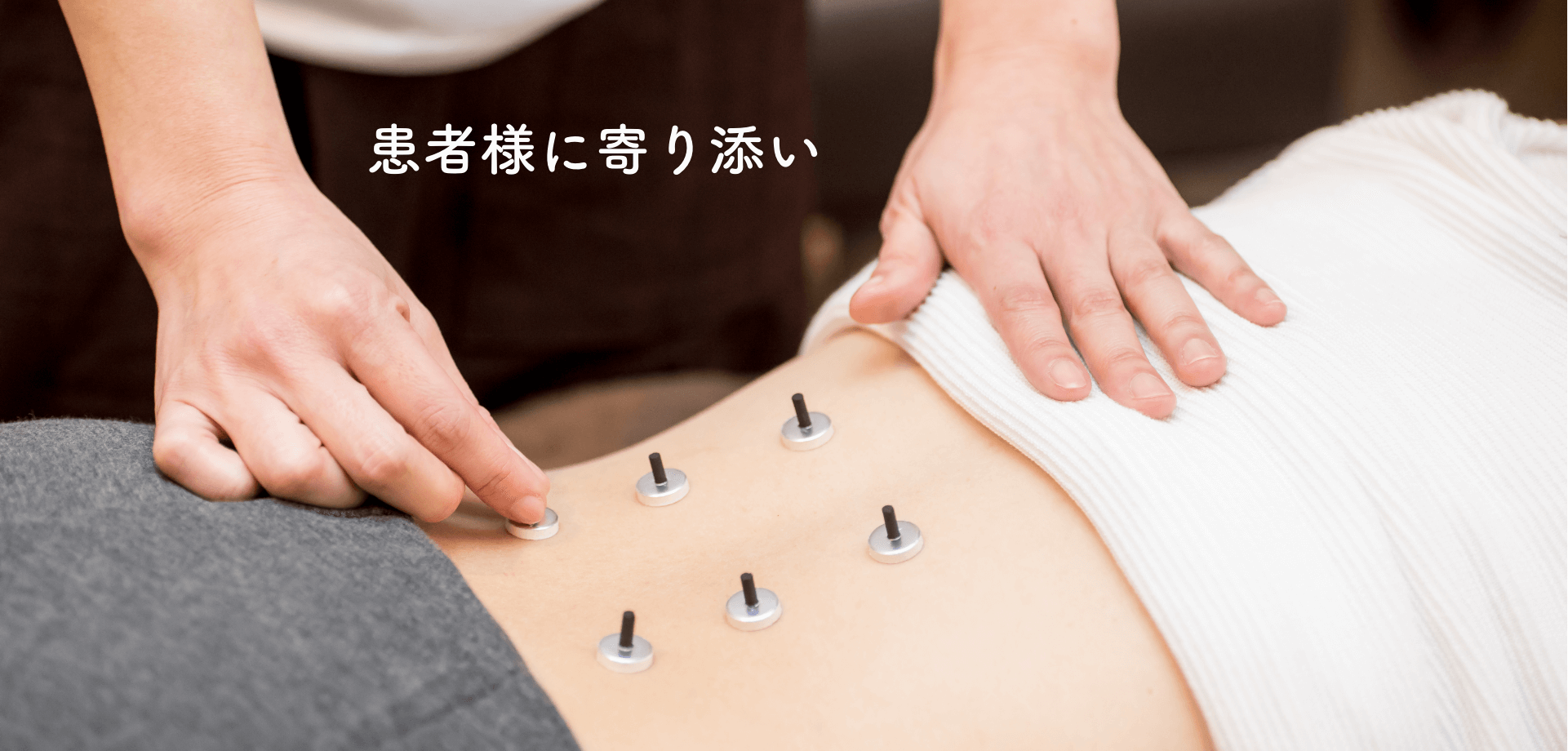 お灸治療の様子