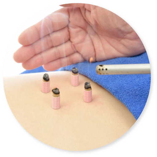 腰のお灸治療の様子